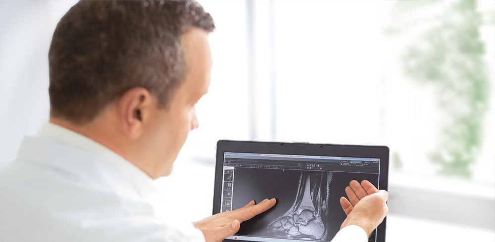 Chefarzt Radiologie Spital Zollikerberg erklärt elektronisches Röntgenbild am Laptop